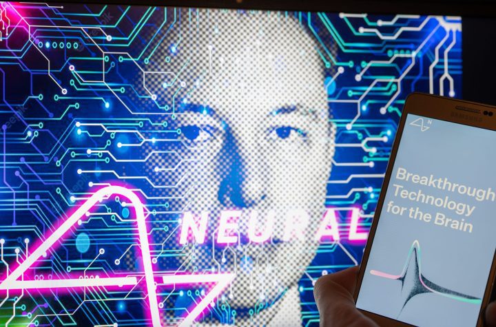 Questi quattro computer cerebrali superano Neuralink ed Elon Musk